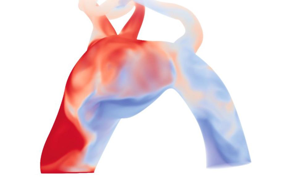 Scalar transport in blood flow in a patient-specific aorta