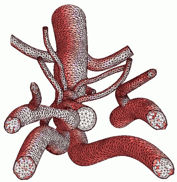 Unstructured boundary layer mesh of a patient-specific geometry